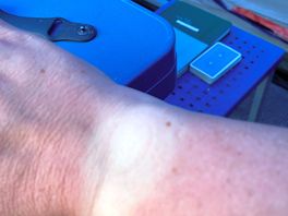 Burnt
