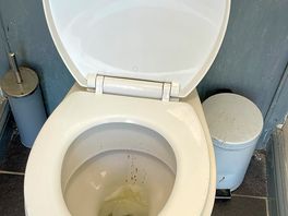 Filthy toilets