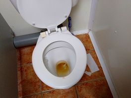 Apologies for disgusting photo