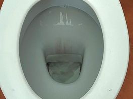 Toilets black inside with inground stains over a long period , need bleaching
